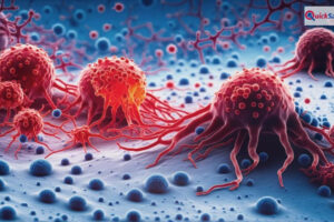 कैंसर के खतरे को कम करने के लिए अपनाएं ये 4 तरीके, डॉक्टर की सलाह