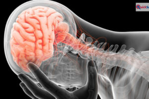 क्या सर्वाइकल का दर्द दिमाग को भी करता है नुकसान? कौन से लक्षण खतरनाक