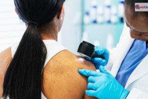 क्या गर्मियों में बढ़ जाता है स्किन कैंसर का खतरा? एक्सपर्ट से जानें