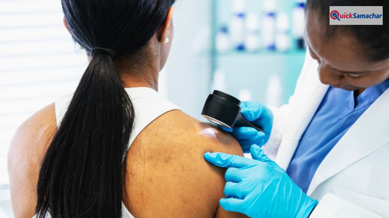 क्या गर्मियों में बढ़ जाता है स्किन कैंसर का खतरा? एक्सपर्ट से जानें