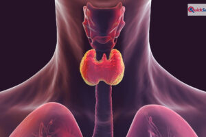 थाइराइड हो गया है तो लें ये डाइट, बीमारी रहेगी कंट्रोल, एक्सपर्ट ने बताया