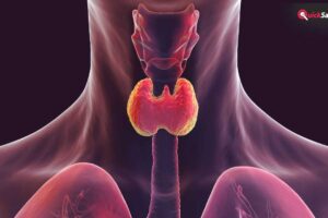 थाइराइड हो गया है तो लें ये डाइट, बीमारी रहेगी कंट्रोल, एक्सपर्ट ने बताया