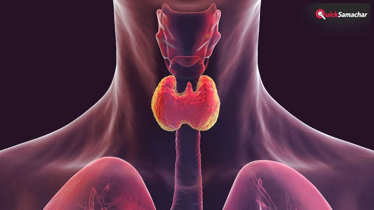 थाइराइड हो गया है तो लें ये डाइट, बीमारी रहेगी कंट्रोल, एक्सपर्ट ने बताया