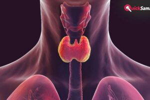 थाइराइड हो गया है तो लें ये डाइट, बीमारी रहेगी कंट्रोल, एक्सपर्ट ने बताया