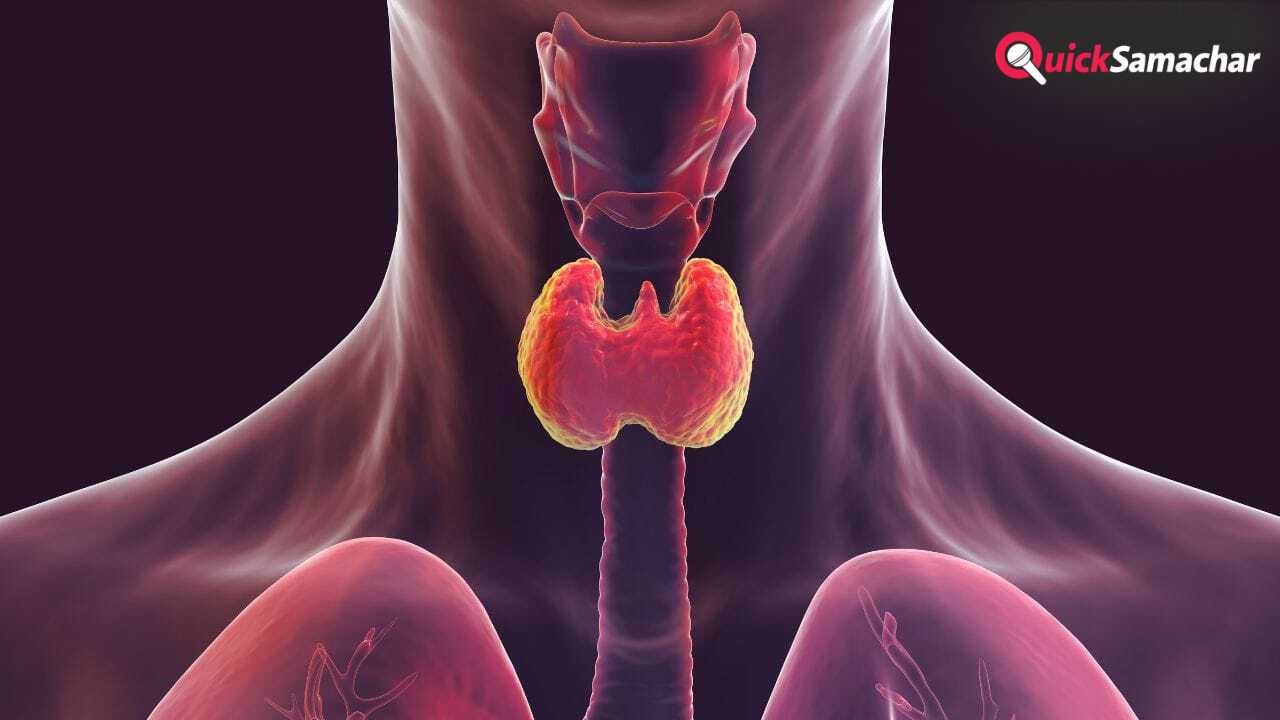 थाइराइड हो गया है तो लें ये डाइट, बीमारी रहेगी कंट्रोल, एक्सपर्ट ने बताया