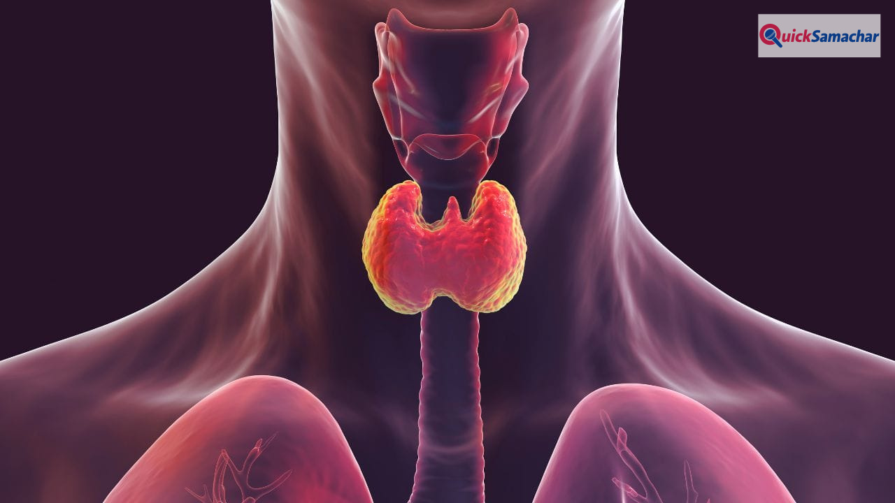थाइराइड हो गया है तो लें ये डाइट, बीमारी रहेगी कंट्रोल, एक्सपर्ट ने बताया