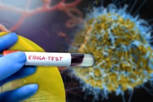 Ebola Case in India: केरलम में इबोला का संदिग्ध मरीज, साउथ सूडान से आई महिला में दिखे लक्षण​