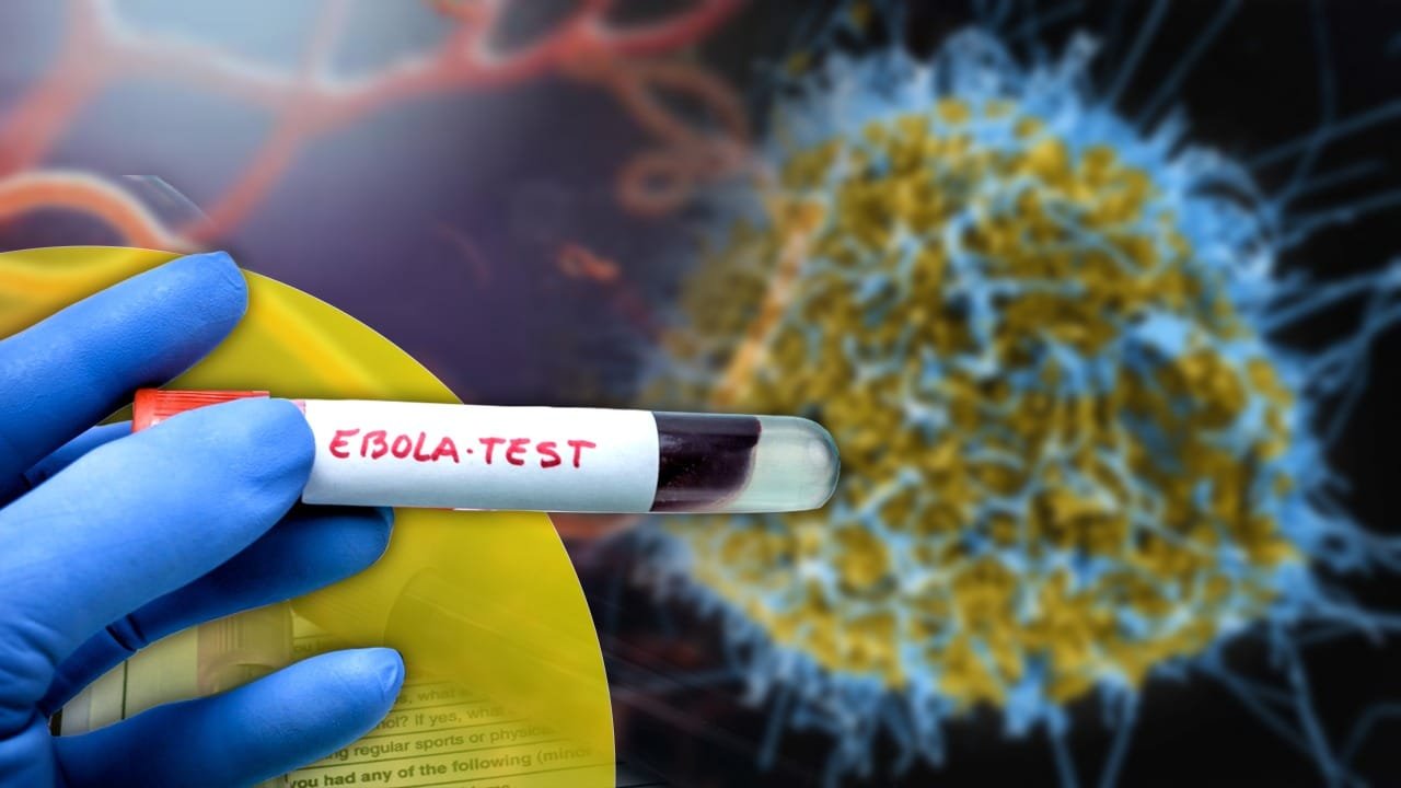 Ebola Case in India: केरलम में इबोला का संदिग्ध मरीज, साउथ सूडान से आई महिला में दिखे लक्षण​
