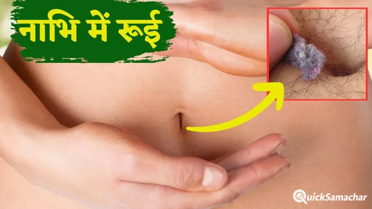 नाभि में रूई क्यों आती है आपके साथ भी आ रही समस्या तो जानिए इसके पीछे का असली कारण और आसान घरेलू इलाज नाभि में रूई क्यों आती है आपके साथ भी आ रही समस्या तो जानिए इसके पीछे का असली कारण और आसान घरेलू इलाज
