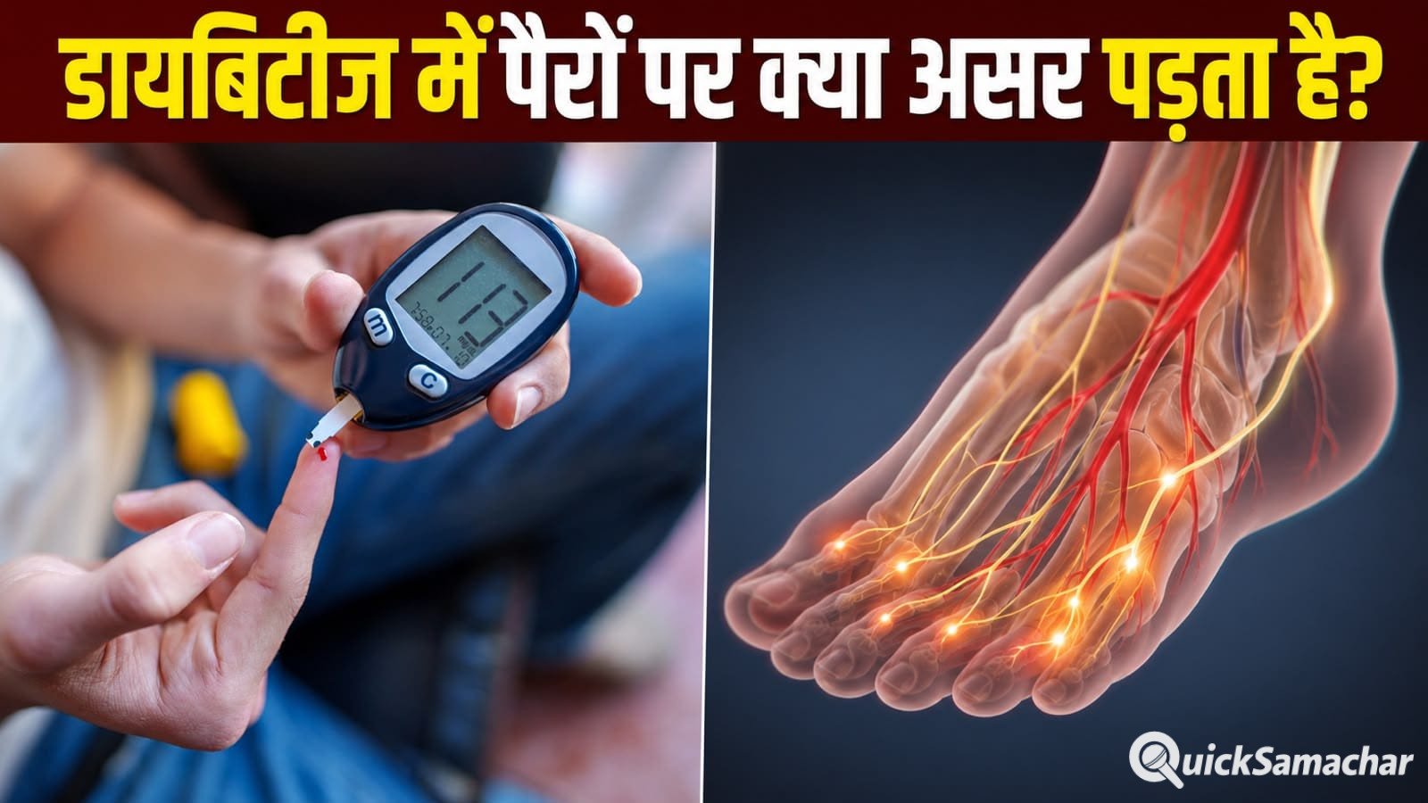 डायबिटीज के दौरान पैरों का खास ख्याल क्यों है जरूरी? जानें बड़ी वजह डायबिटीज के दौरान पैरों का खास ख्याल क्यों है जरूरी? जानें बड़ी वजह