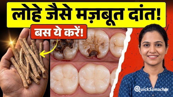 दांतों में सड़न बढ़ने से पहले जान लें ये 4 घरेलू नुस्खे, कैविटी से बचाव में हो सकते हैं असरदार.. दांतों में सड़न बढ़ने से पहले जान लें ये 4 घरेलू नुस्खे, कैविटी से बचाव में हो सकते हैं असरदार..