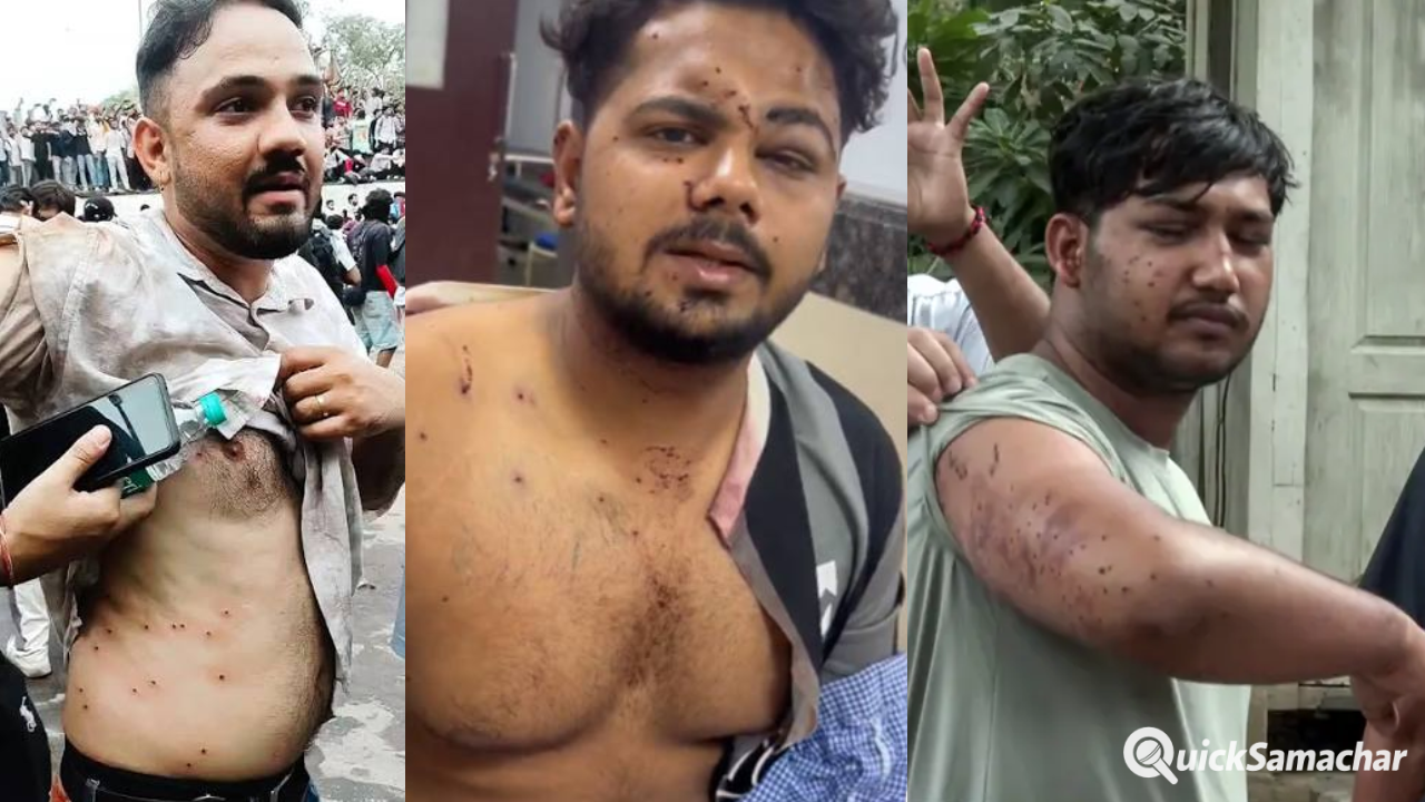 Explainer: आखिर क्या है ये पैलेट गन जिसकी वजह से देशभर में मचा बवाल, कब और किन परिस्थितियों में होता है इस्तेमाल? Explainer: आखिर क्या है ये पैलेट गन जिसकी वजह से देशभर में मचा बवाल, कब और किन परिस्थितियों में होता है इस्तेमाल?