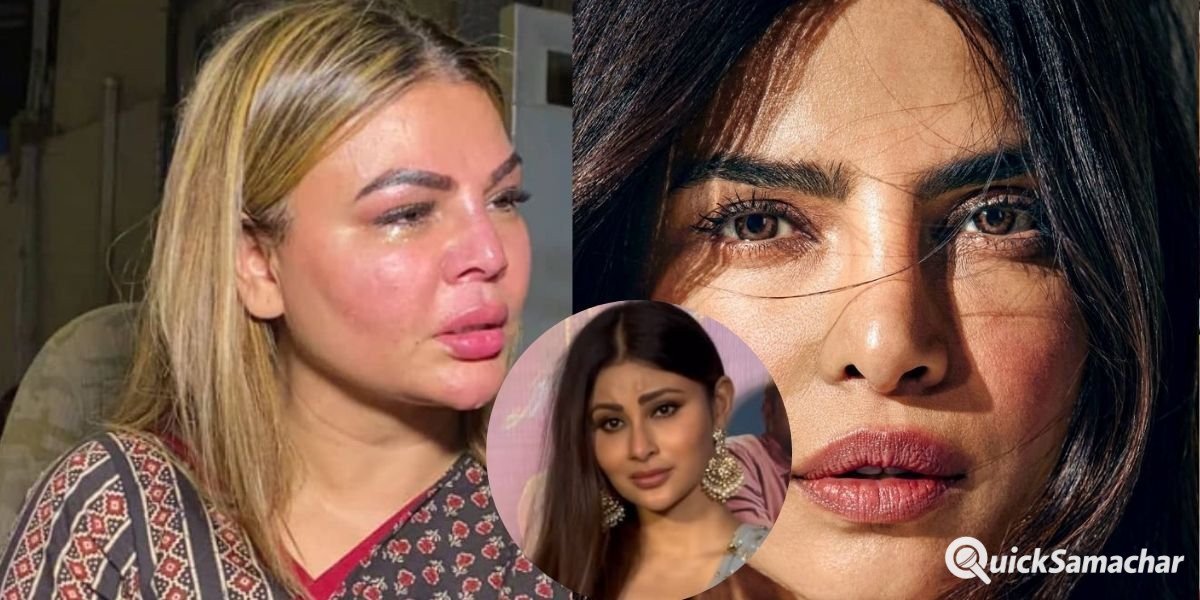 ज्यादा सुंदर दिखने की चाहत में चेहरा बिगाड़ बैठीं ये हसीनाएं, किसी के सूजे होंठ, किसी का बिगड़ा माथा 1 Bollywood Actress These Beauties Ruined Their Faces In The Desire To Look More Beautiful