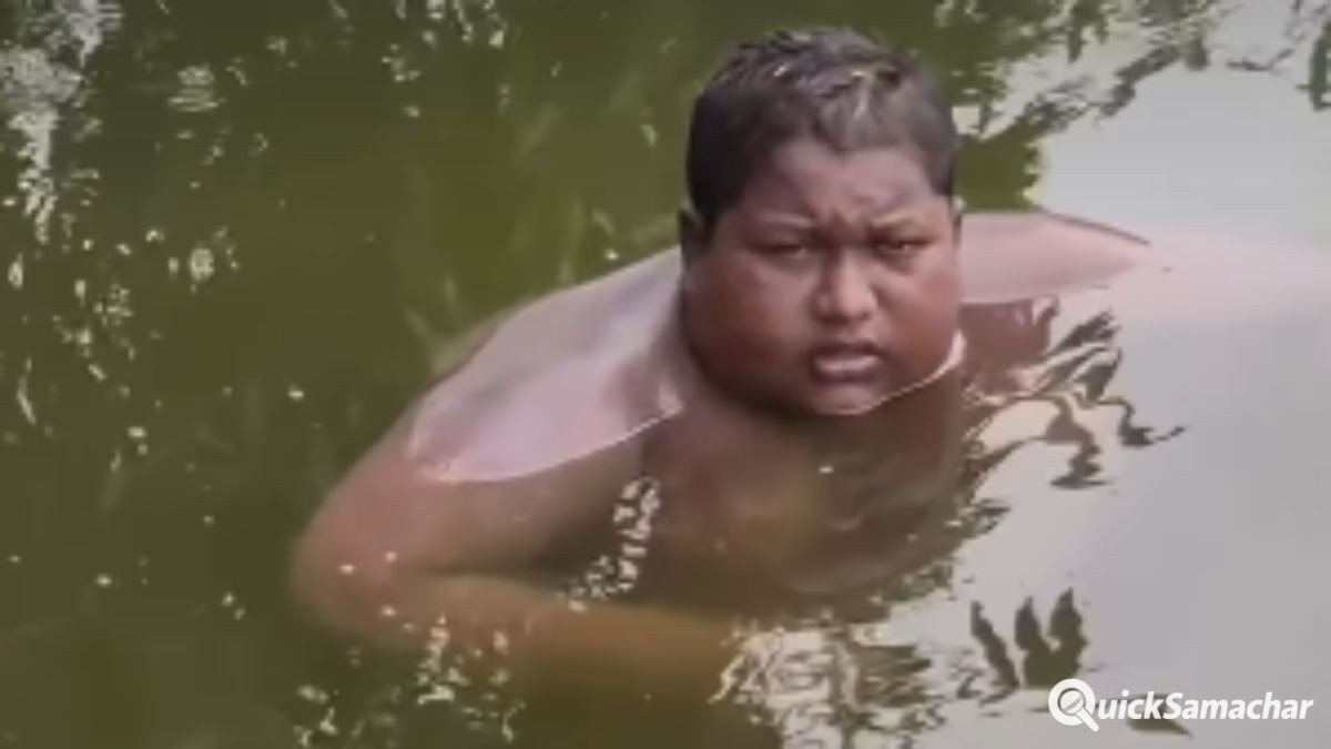5 साल से तालाब में रह रहा 16 साल का इकबाल, पानी से बाहर आते ही शरीर जलने लगता है; खाना-पीना और सोना सब पानी में