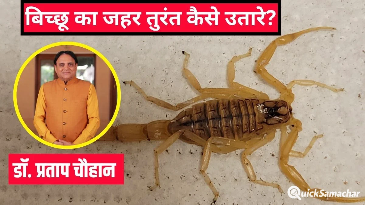 बिच्छू का जहर तुरंत कैसे उतारे? आयुर्वेदिक डॉक्टर ने बताया बिच्छू के काटने पर क्या करना चाहिए