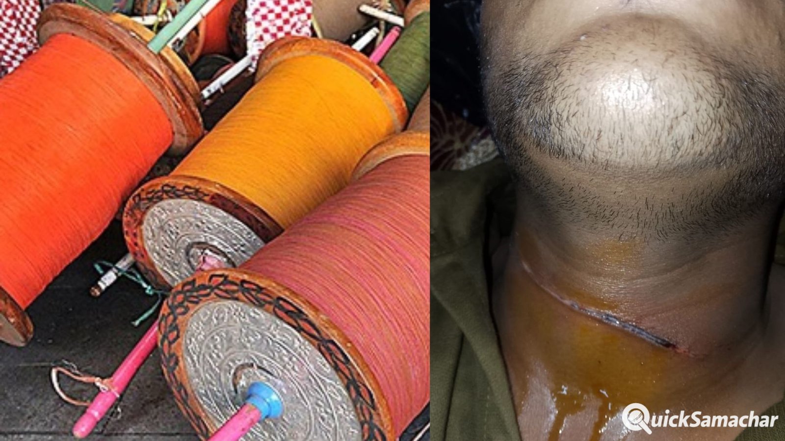 Bareilly News: बरेली में चाइनीज मांझे एक और छात्र की कटी गर्दन, पिछले कुछ दिनों में हो चुकीं कई घटनाएं Bareilly News: बरेली में चाइनीज मांझे एक और छात्र की कटी गर्दन, पिछले कुछ दिनों में हो चुकीं कई घटनाएं