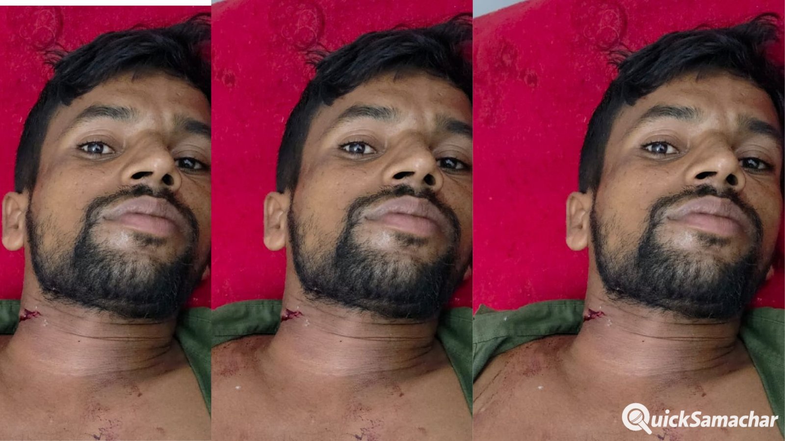 Bareilly News : बरेली में चोरों ने झोंकी फायर, युवक की गर्दन में फंसी गोली, फिर भी दिनभर घूमता रहा घायल Bareilly News : बरेली में चोरों ने झोंकी फायर, युवक की गर्दन में फंसी गोली, फिर भी दिनभर घूमता रहा घायल