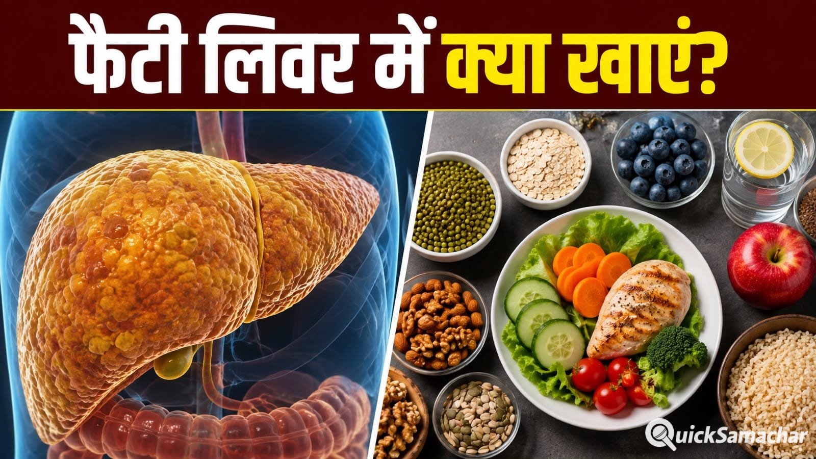 फैटी लिवर में कौन से फूड्स खाना जरूरी हैं? जानें सही डाइट फैटी लिवर में कौन से फूड्स खाना जरूरी हैं? जानें सही डाइट