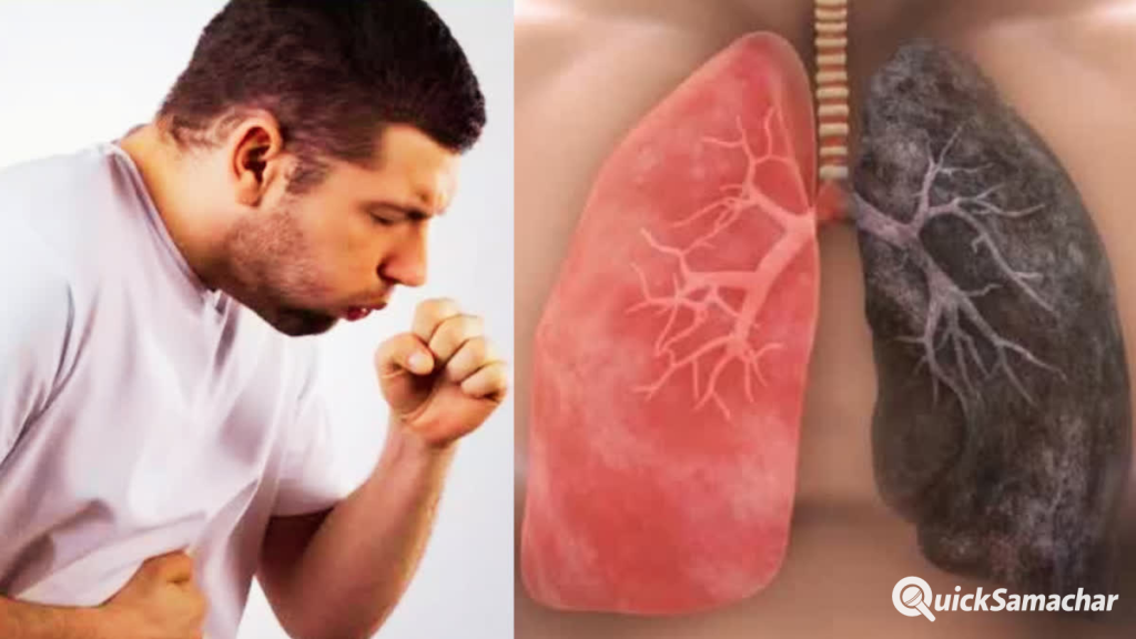 बार-बार सांस फूलती है? अस्थमा और ब्रोंकाइटिस (COPD) के इन संकेतों को भूलकर भी नजरअंदाज न करें बार-बार सांस फूलती है? अस्थमा और ब्रोंकाइटिस (COPD) के इन संकेतों को भूलकर भी नजरअंदाज न करें