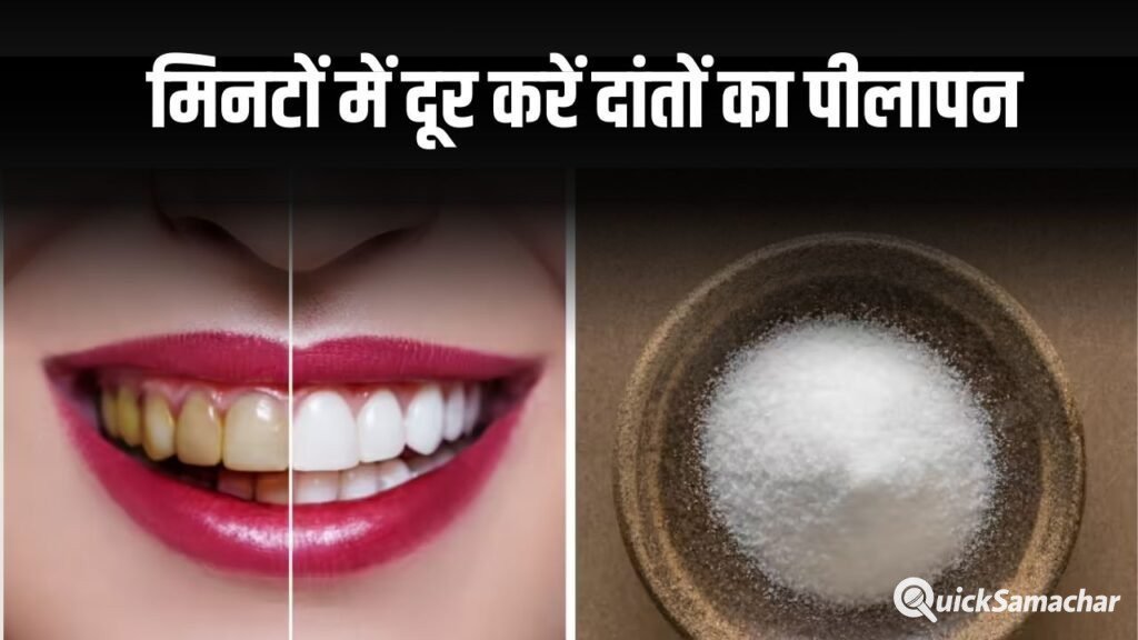 दांतों का पीलापन दूर करें, आयुर्वेदिक तरीके से फिटकरी से पाएं झटपट सफाई, जानें तरीका!