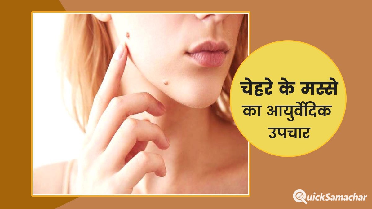 ayurvedic-remedies-for-masse-main
