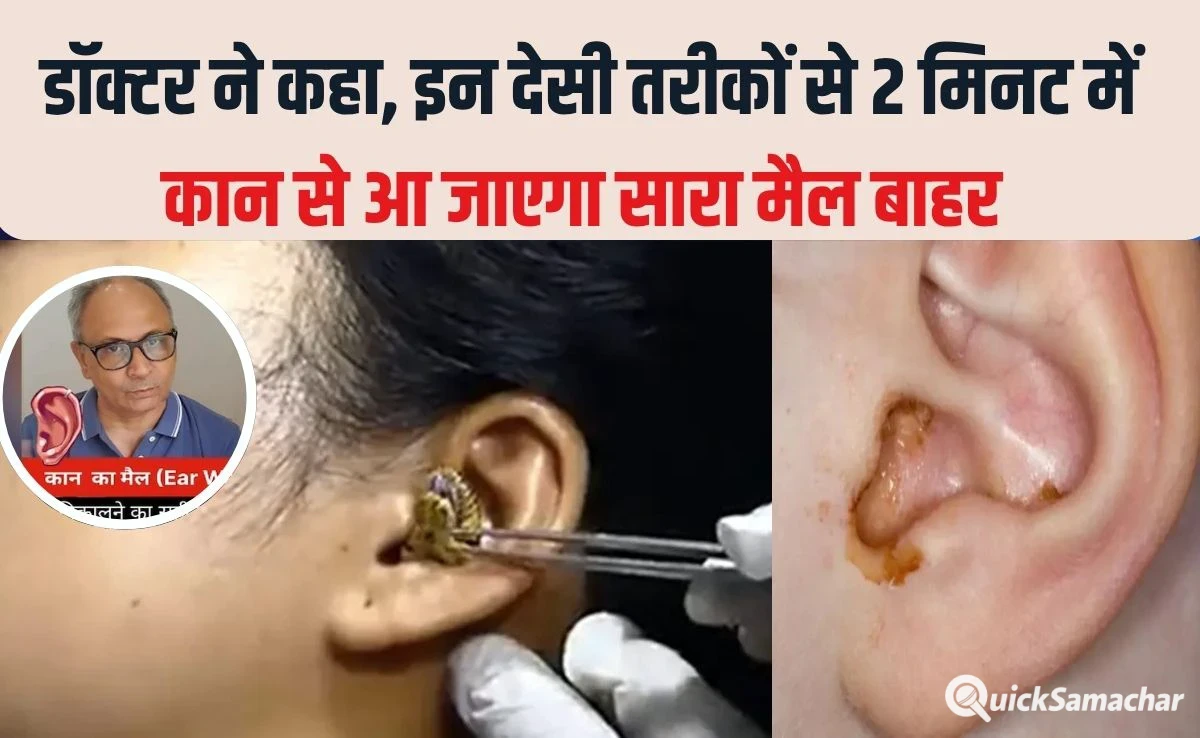 2 मिनट में कान का मैल आ जाएगा बाहर, सरसों के तेल में बस यह सफेद चीज मिलाकर डालें